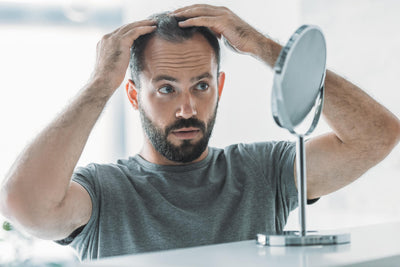 Holistic Support for Male Hair Loss